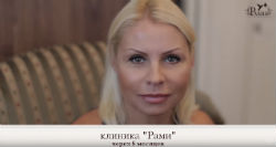 Фейслифтинг нитями APTOS в клинике РАМИ видео. Фейслифтинг нитями APTOS в клинике РАМИ видео.