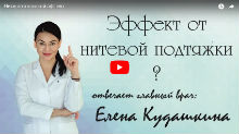 Эффект от нитей АПТОС. Видео Эффект от нитей АПТОС. Видео
